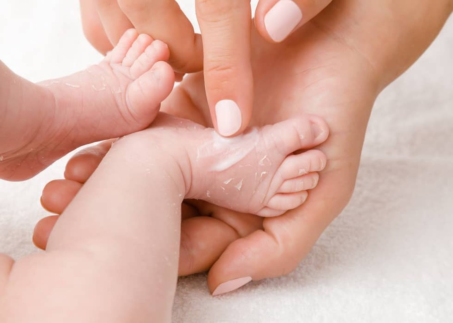 Wat moet je doen als je baby een droge huid - Pazzox