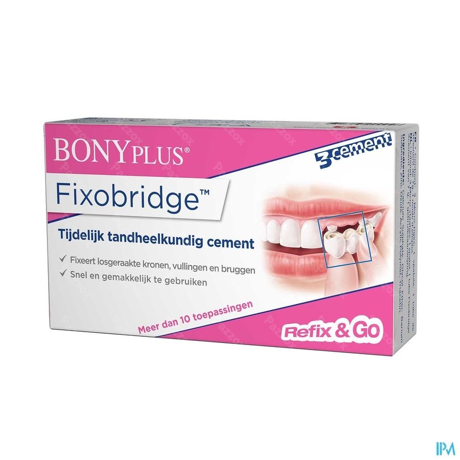 Bonyplus Fixobridge Vr Losgekomen Kronen-bruggen7g