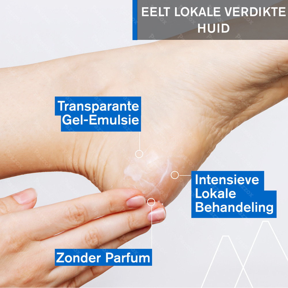 Uriage Kératosane 30% Ureum Droge en Ruwe Huid 40ml