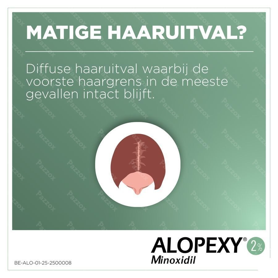 Alopexy 2 % Liquid Fl Pipet/spray 1x60ml
