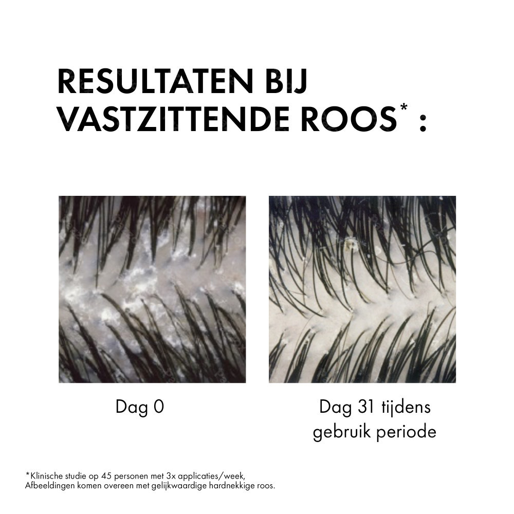 Vichy Dercos Anti-Roos Shampoo Normaal Tot Vet Haar 200ml