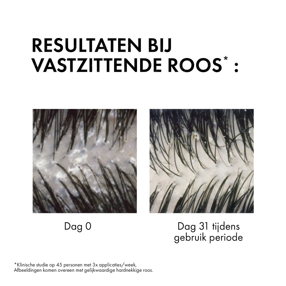 Vichy Dercos Anti-Roos Shampoo Normaal Tot Vet Haar 390ml
