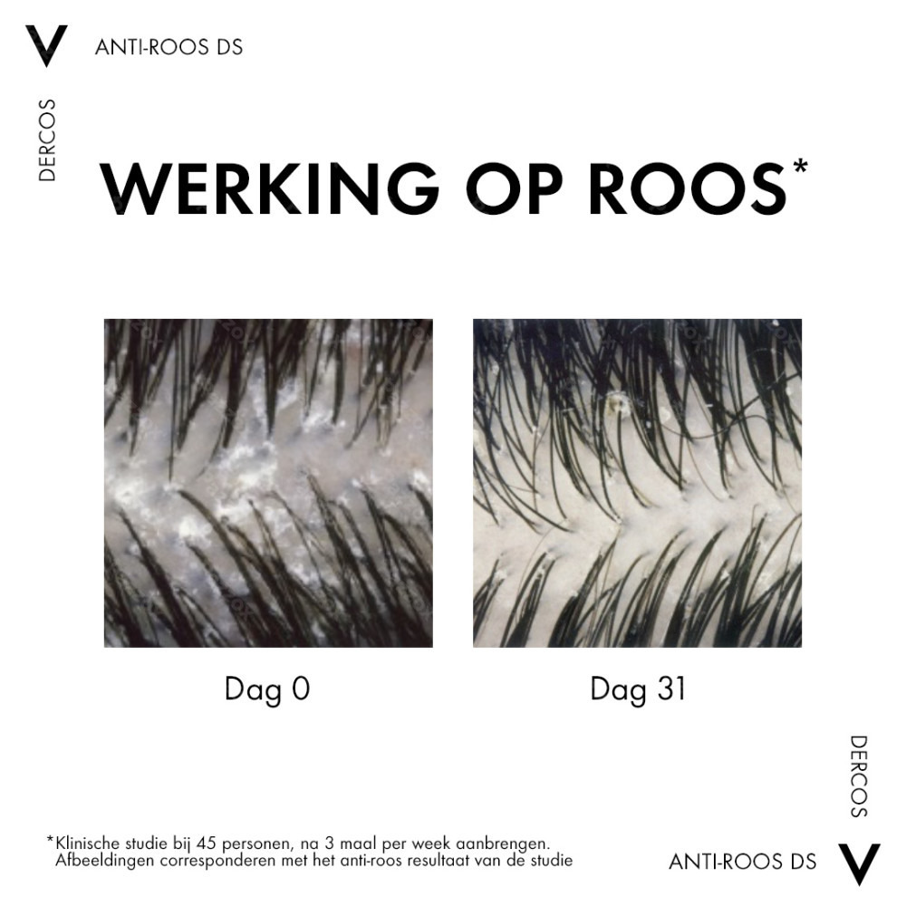 Vichy Dercos Anti Roos Shampoo Droog Haar 390ml