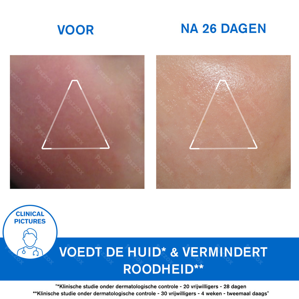 Uriage Xémose Gezichtscrème Zeer Droge Huid 40ml