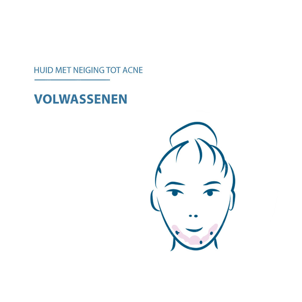Ducray Keracnyl Serum Anti-Onzuiverheden Volwassen Huid 30ml
