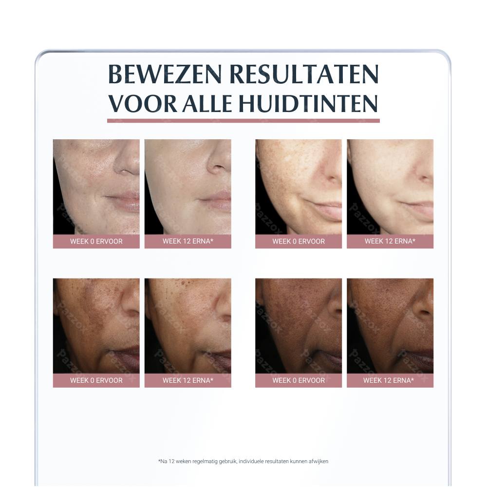 Eucerin Anti-Pigment Serum Duo Hyperpigmentatie 30ml
