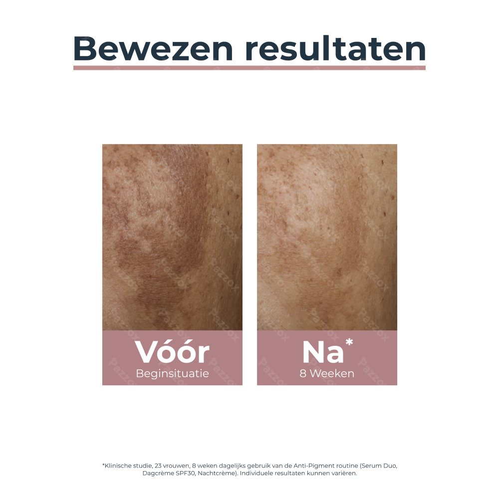 Eucerin Anti-Pigment Nachtcrème Hyperpigmentatie 50ml