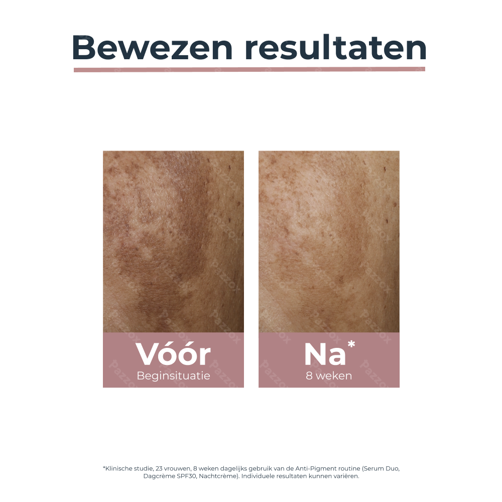 Eucerin Anti-Pigment Dagcrème Hyperpigmentatie SPF30 50ml