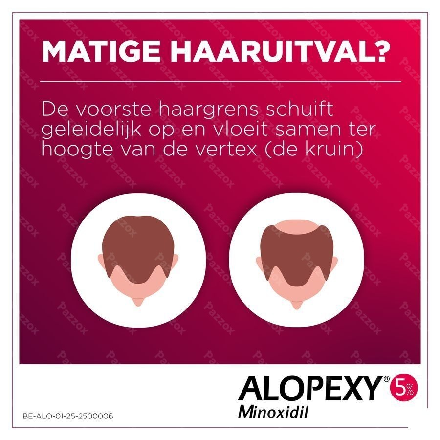 Alopexy 50mg/ml 60ml