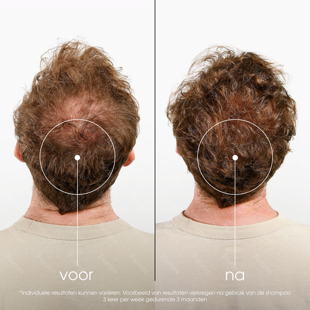 Klorane Shampoo Kinine & Edelweiss 400ml