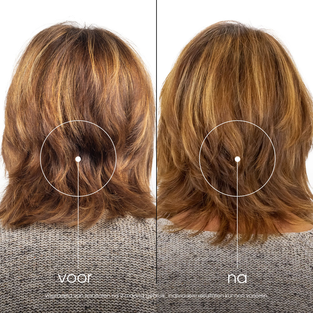 Klorane Capil. Sh Granaatappel 400ml