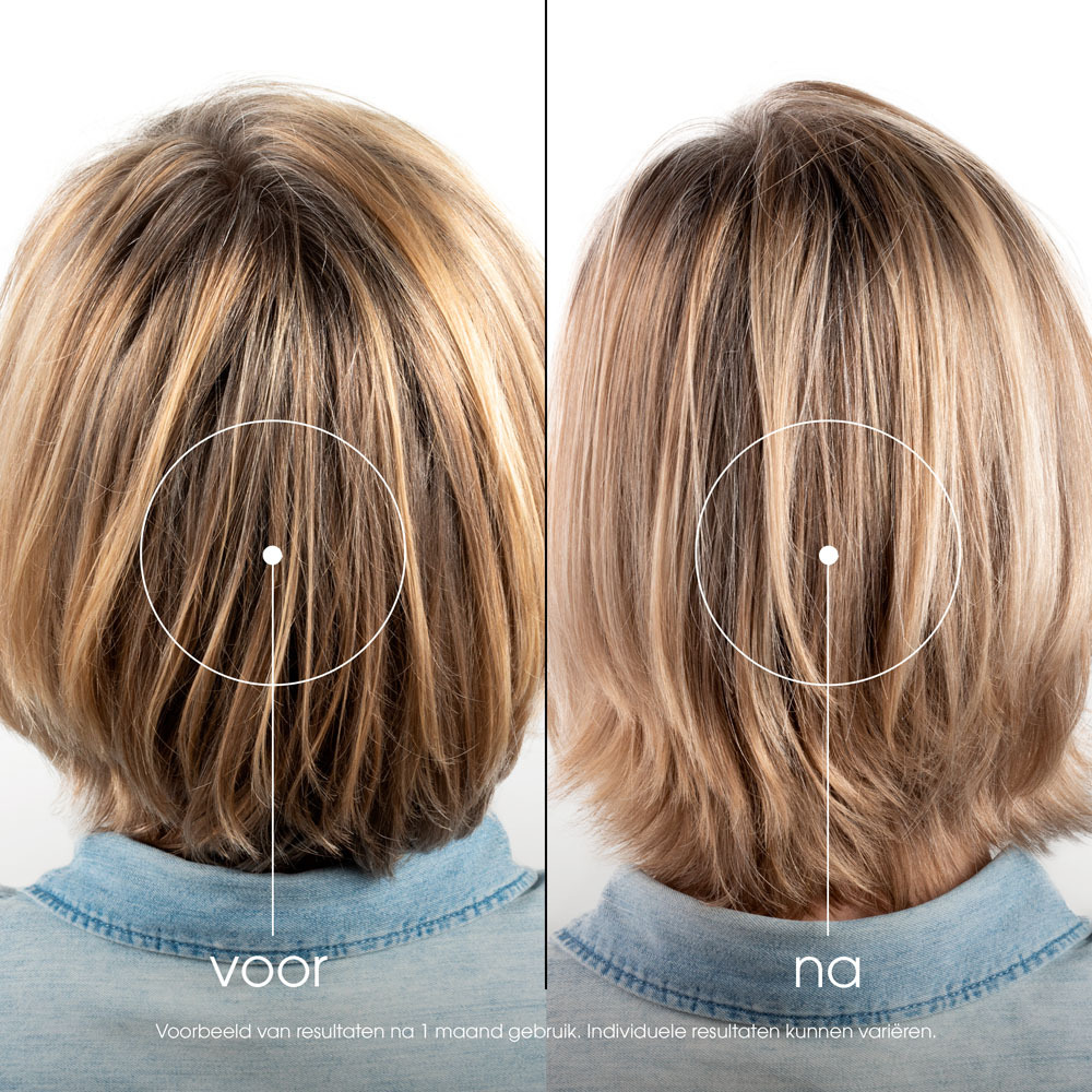 Klorane Capil. Sh Duizendguldenkruid Fl 400ml