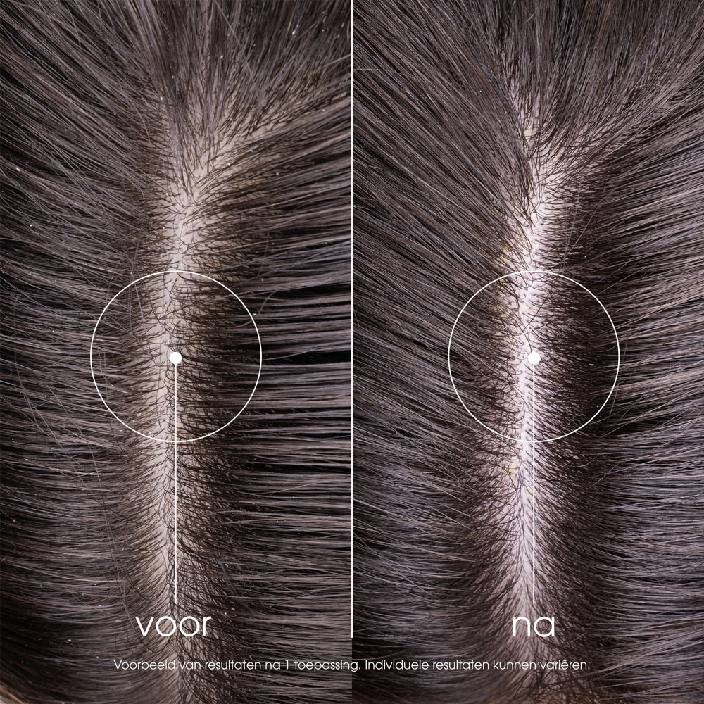 Klorane Shampoo Cederappel 400ml Nf