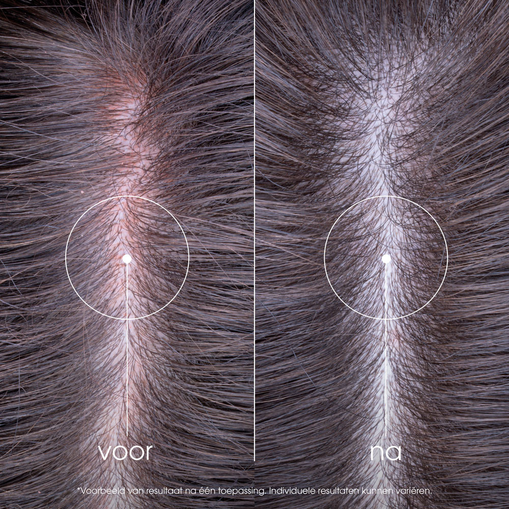 Klorane Sos Serum Pioenroos Bio 100ml