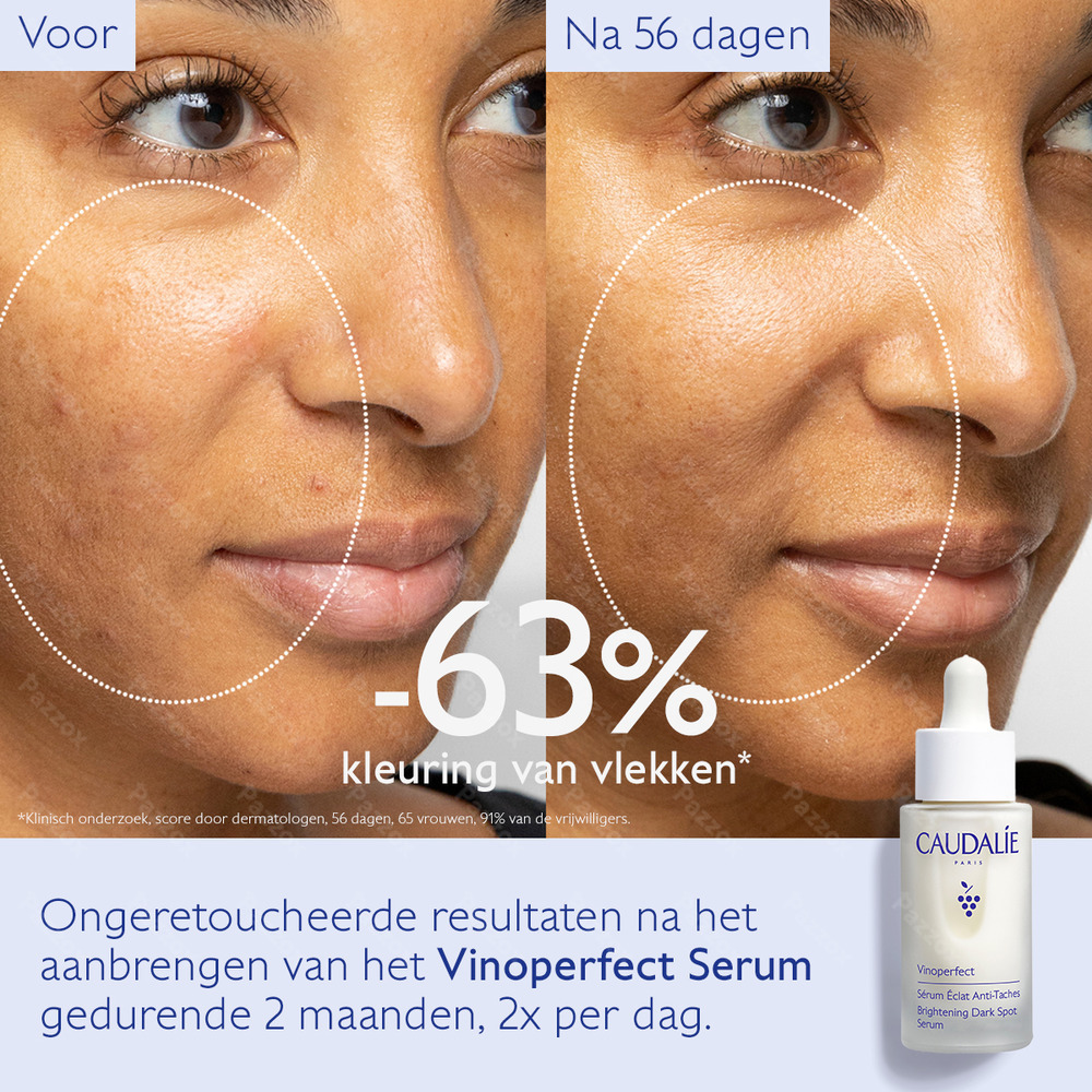 Caudalie Vinoperfect Serum Stralende Huid Anti-Pigment 30ml
