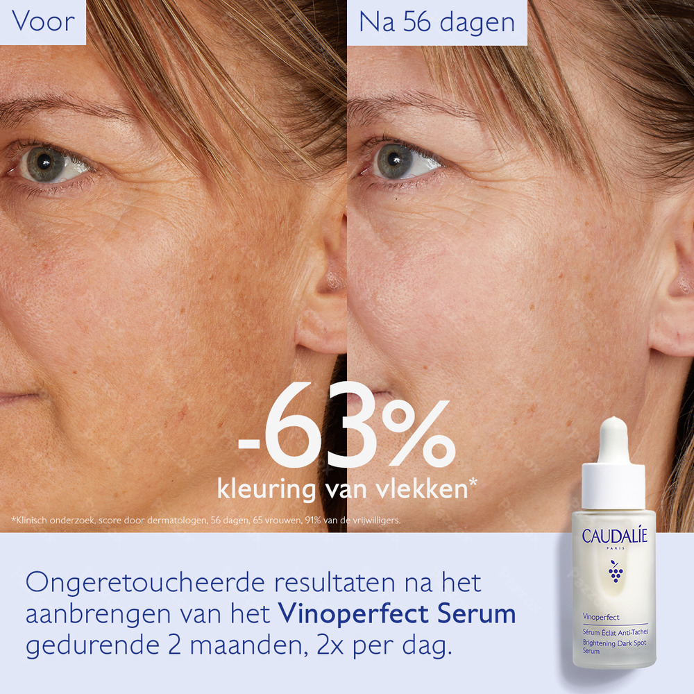 Caudalie Vinoperfect Serum Stralende Huid Anti-Pigment 30ml