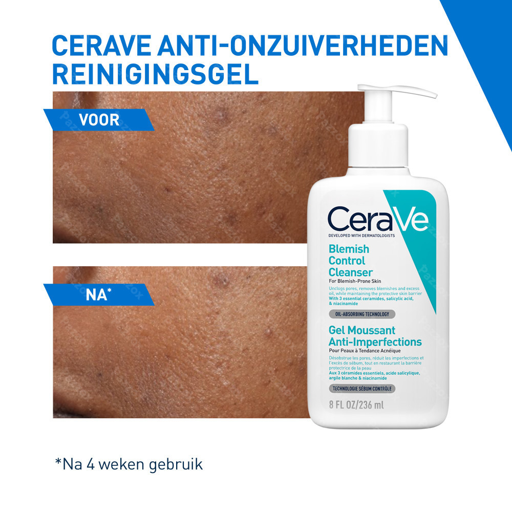 CeraVe Anti Onzuiverheden Reinigingsgel 236ml