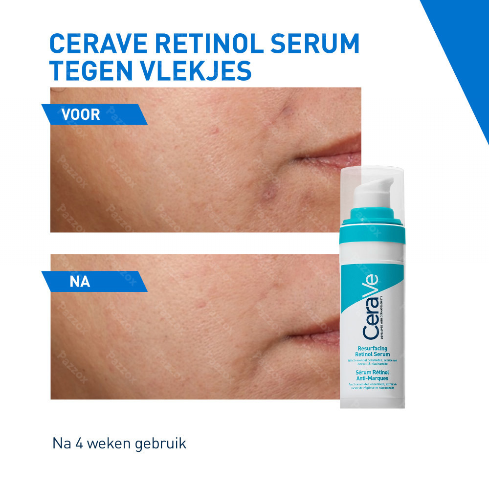 CeraVe Anti Onzuiverheden Reinigingsgel 236ml
