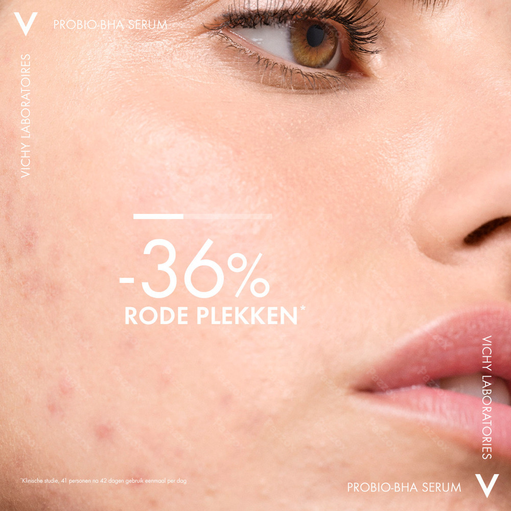 Vichy Normaderm Serum Anti-Onzuiverheden 30ml