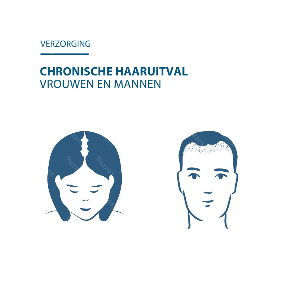 Ducray Anacaps Expert Chronische Haaruitval 90 Capsules