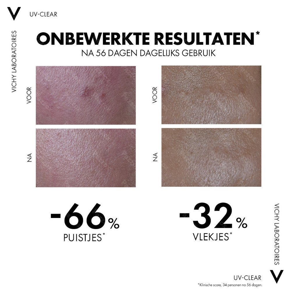 Vichy Capital Soleil Uv Clear SPF50+ 40ml