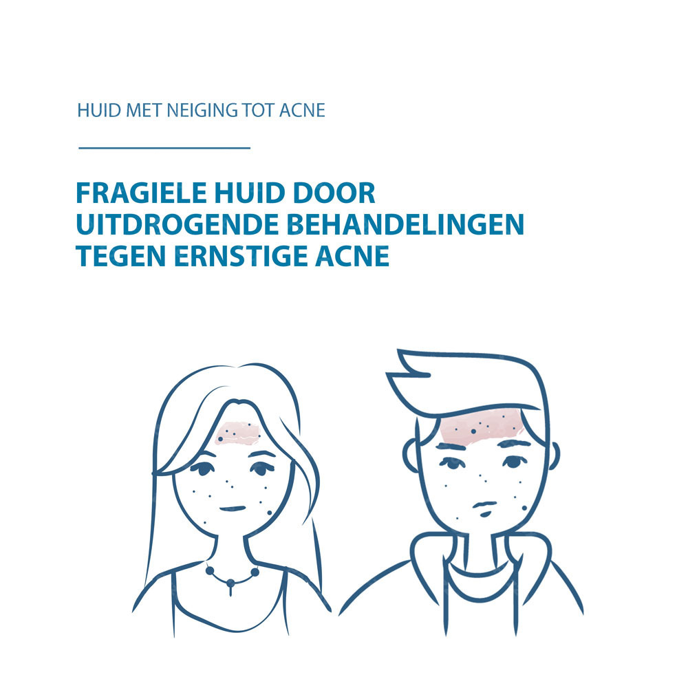 Ducray Keracnyl Repair Compenserende Crème 50ml