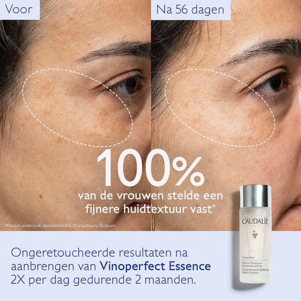 Caudalie Vinoperfect Verhelderende Lotion Anti-Pigment 100ml