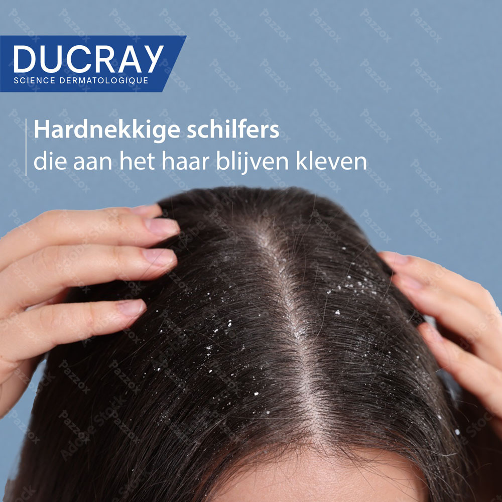 Ducray Kelual Squanorm Shampoo Vette schilfers 400ml