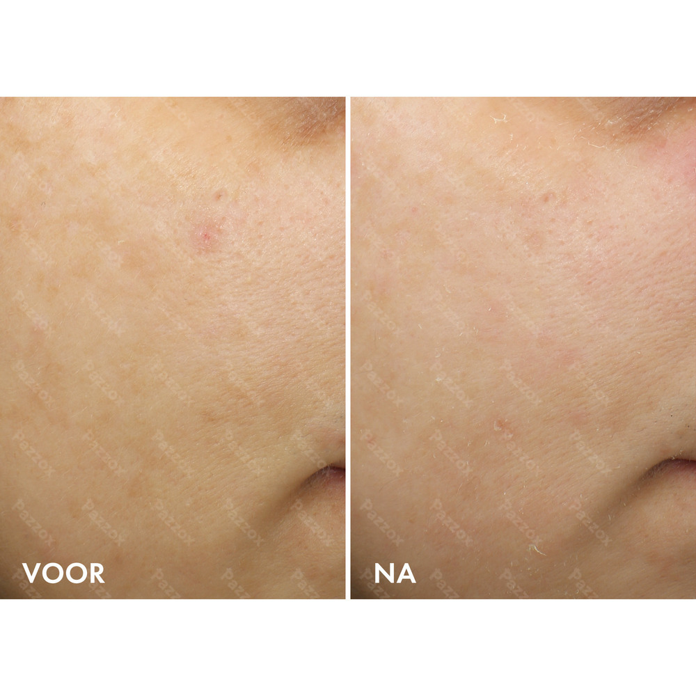 Vichy Liftactiv B3 Pure Retinol Nachtcrème 50ml