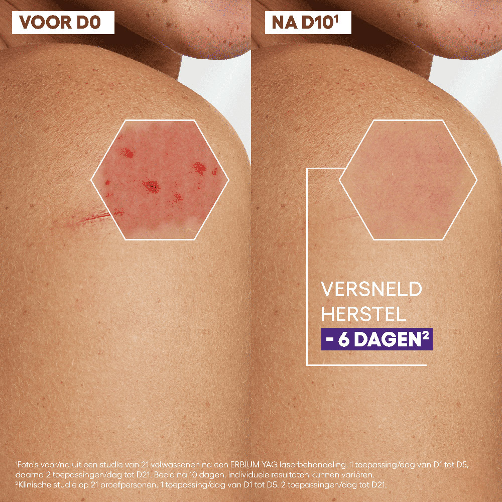 Aderma Epitheliale Creme A/vlekken 100ml