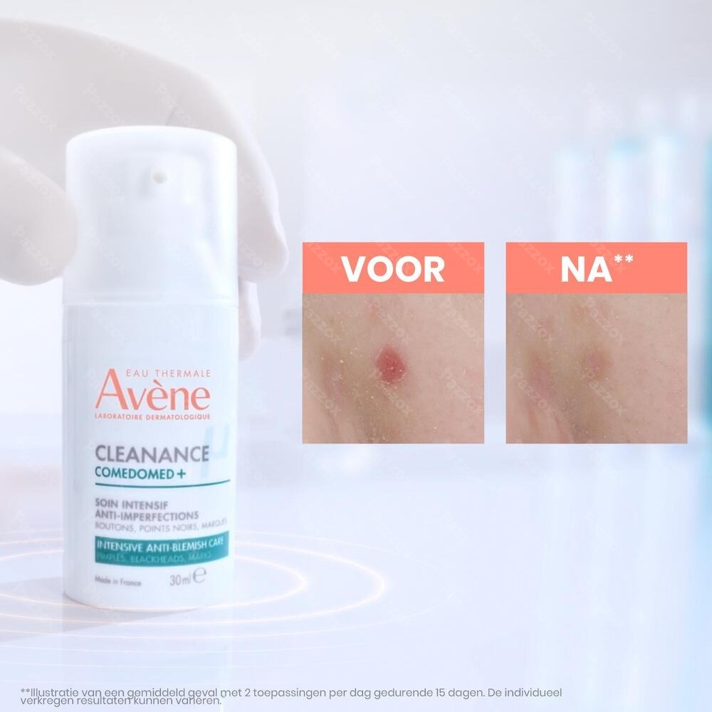 Avene Cleanance Comedomed+ 30ml