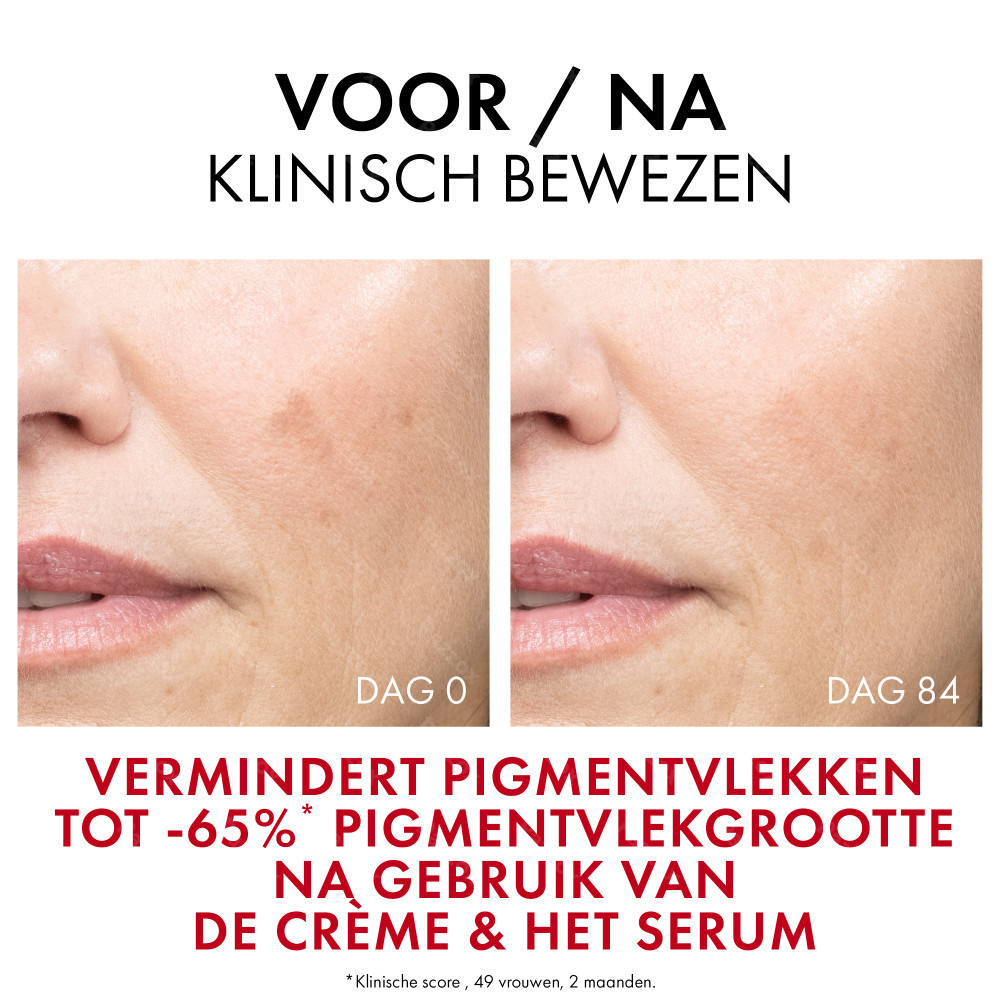 Vichy Liftactiv B3 Anti-Pigmentvlekken Dagcrème SPF50 50ml