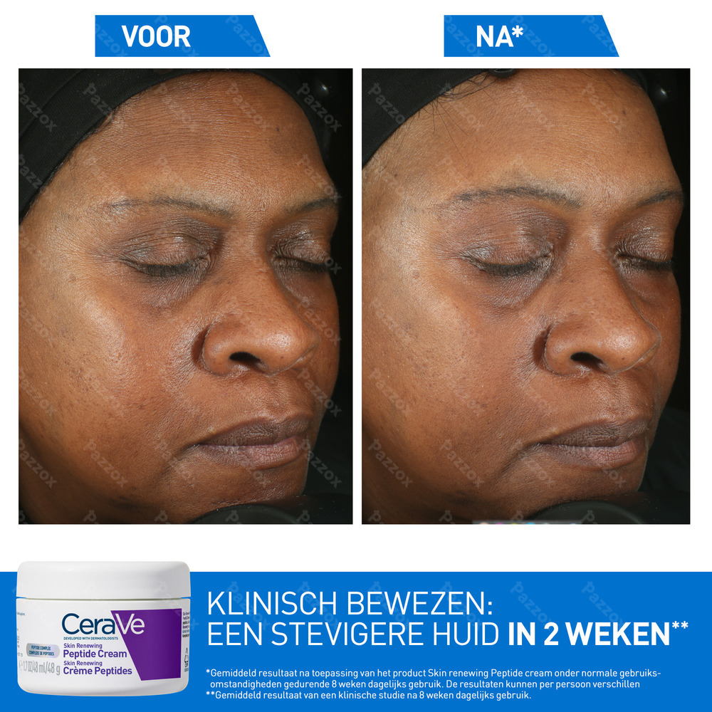 CeraVe Skin Renewing Peptide Cream 48ml
