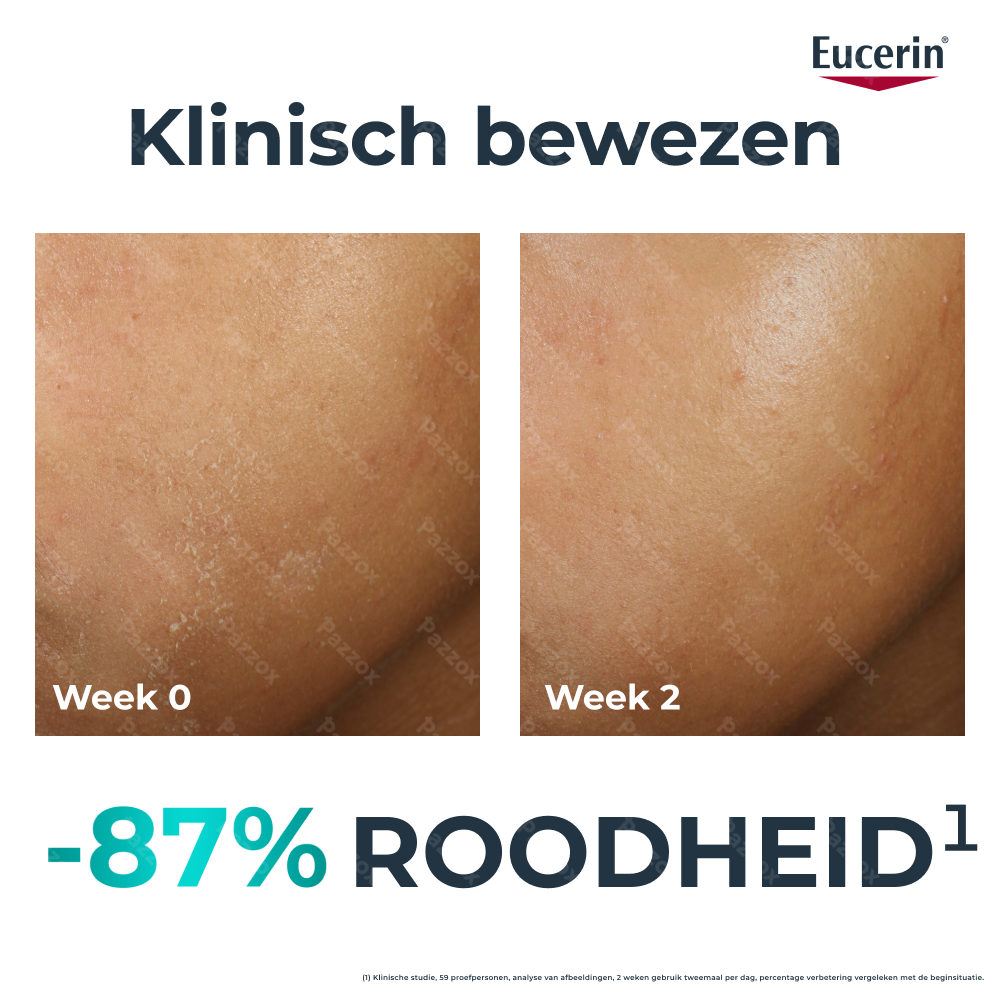 Eucerin Dermopure Clinical Hydra Repair Droge Huid door Behandeling 40ml