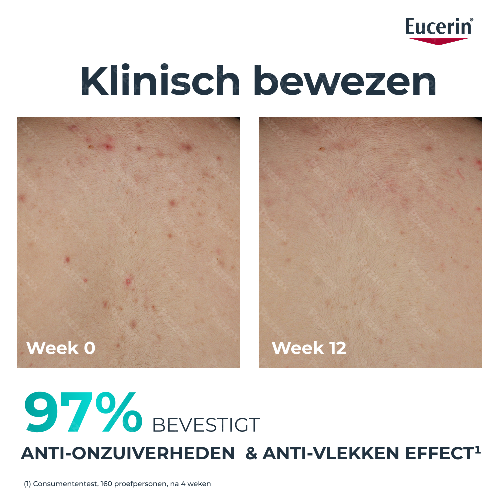 Eucerin Dermopure Clinical Corrigerende Lichaamsverzorging 200ml