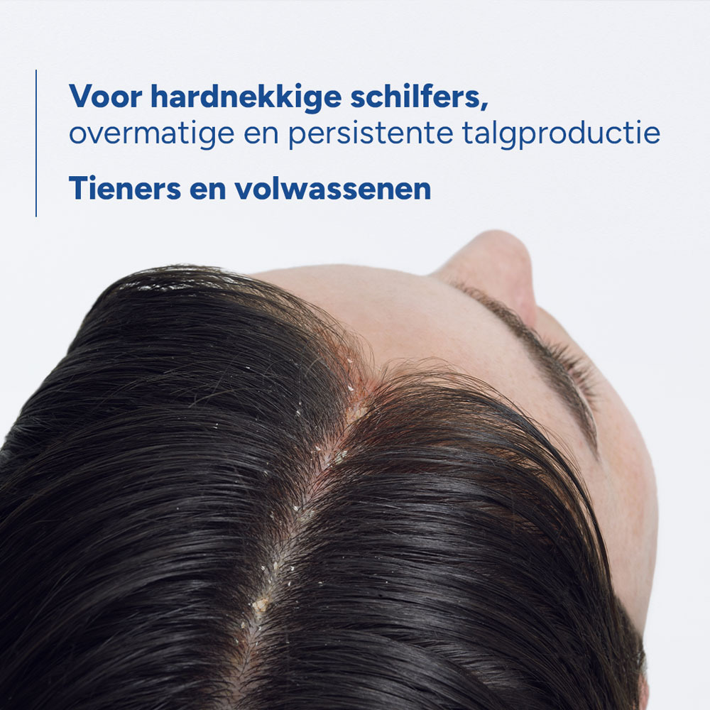 Ducray Kelual DS Sebocontrol Behandelende Anti-roos Shampoo, Ernstige schilfers, Overmatig en hardnekkig talg 100ml