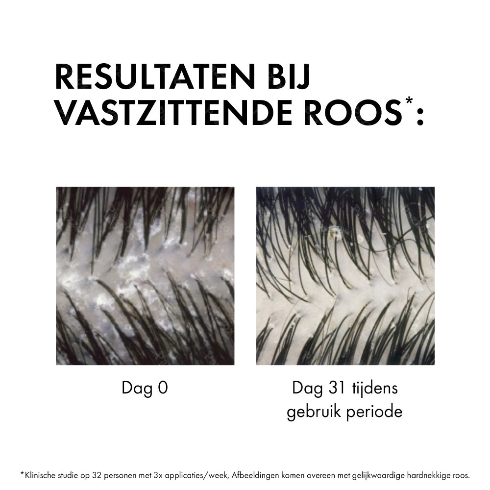 Vichy Dercos Anti-Roos DS Shampoo Navulling Normaal tot Vet Haar